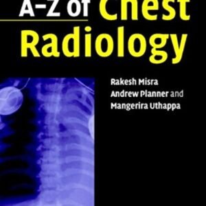 AZ of Chest Radiology.pdf