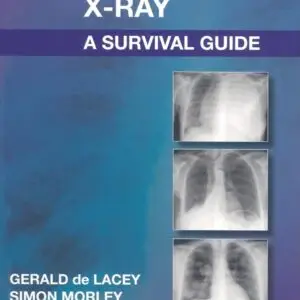 The Chest X Ray A Survival Guide.pdf